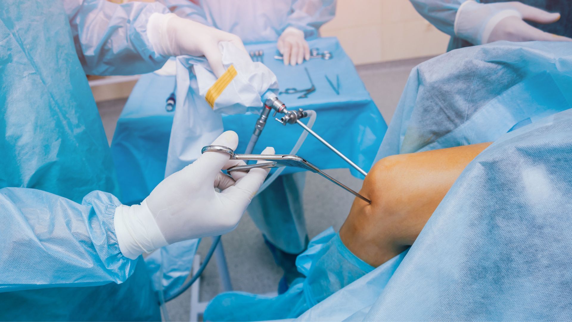 Arthroscopic Procedures in Sports Medicine: Uses and Benefits