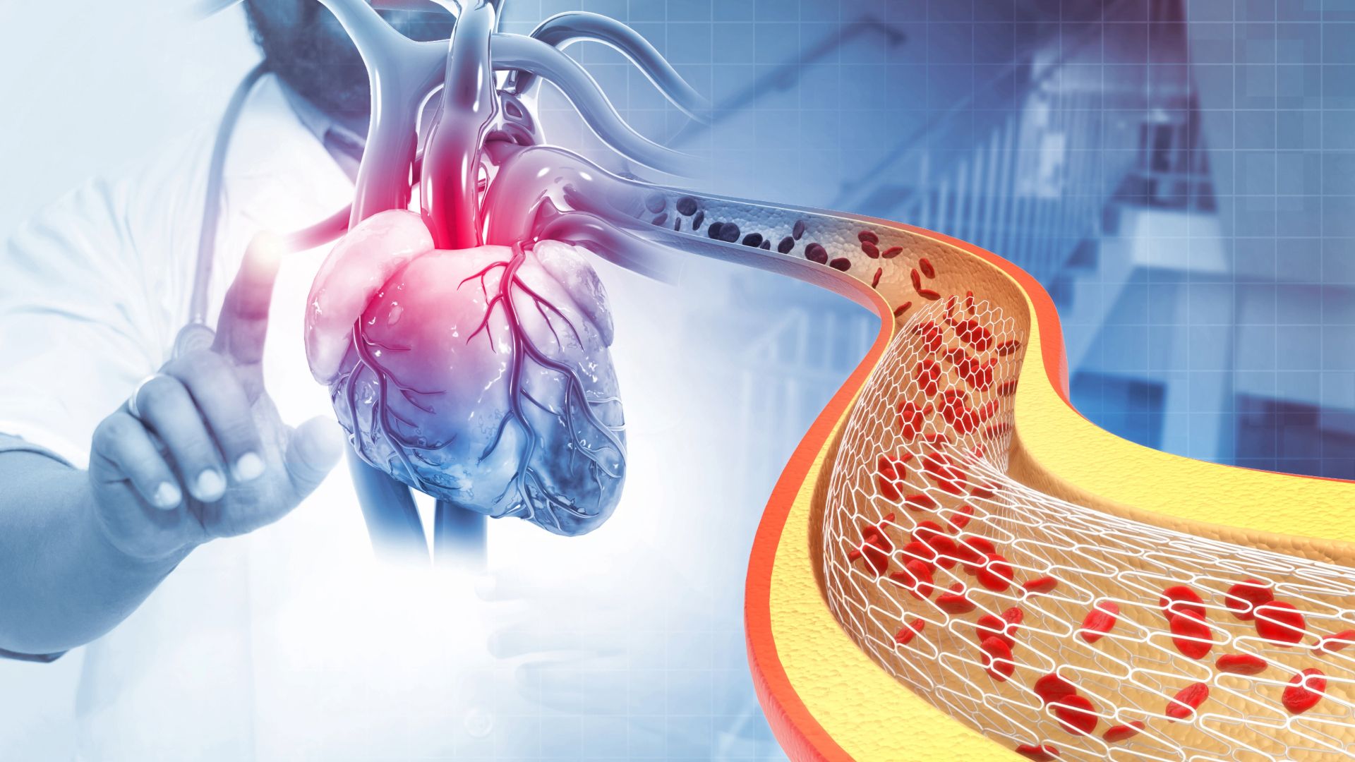 Understanding the Difference between Bioresorbable Scaffold and Drug-Eluting Stent in Heart Care