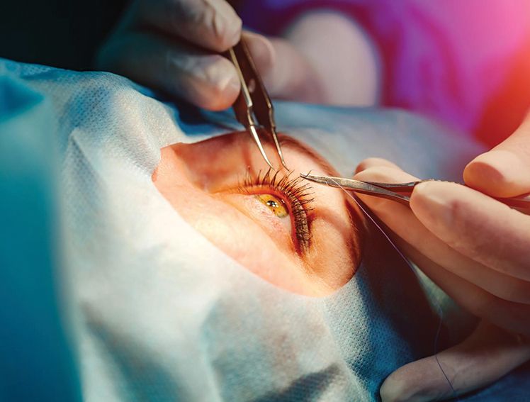 CATARACT- Its causes, symptoms, prevention, diagnosis, and treatment