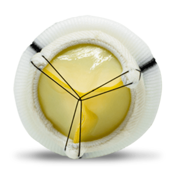 Dafodil™ Pericardial Bioprosthesis