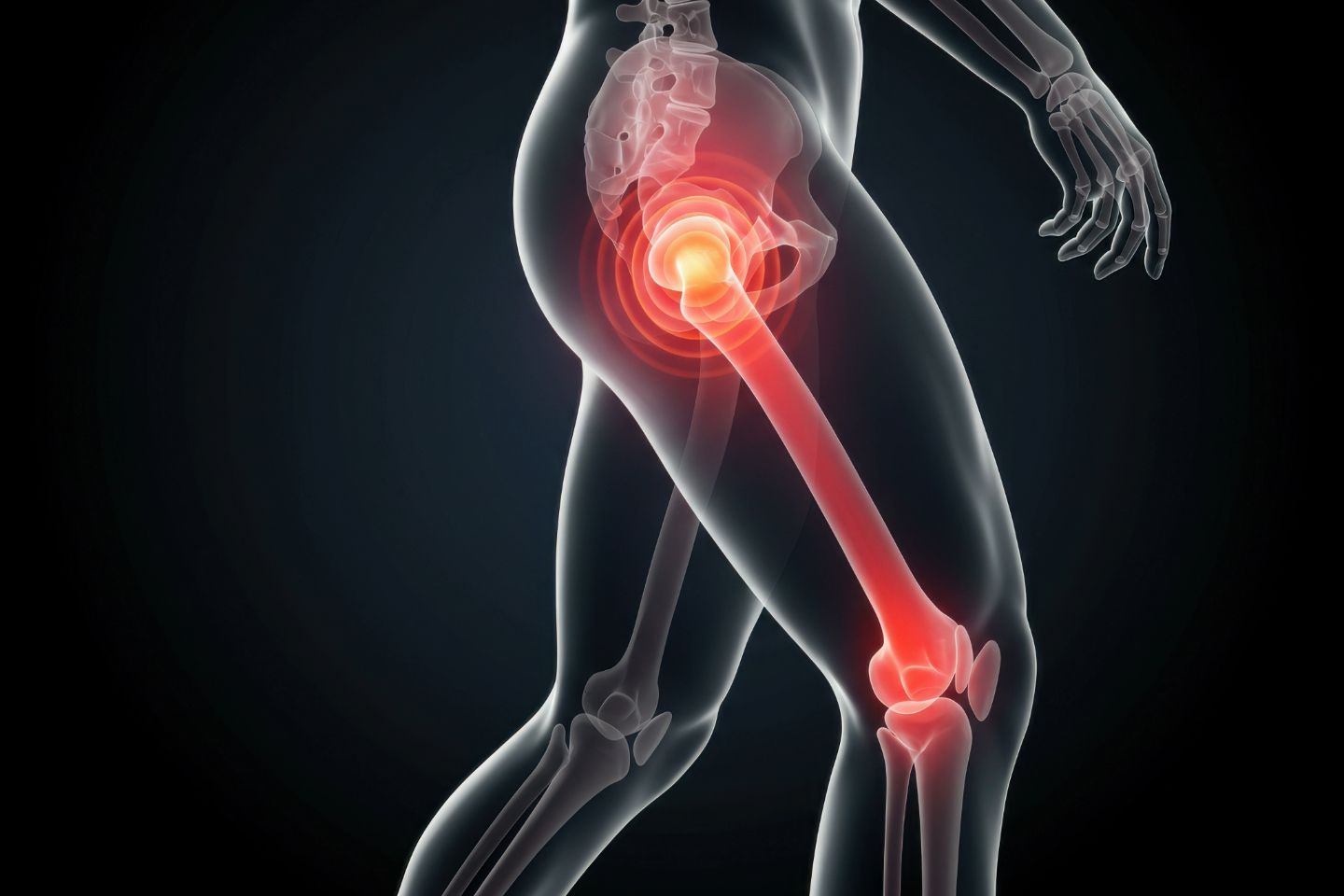 How Do I Know If My Knee or Hip Pain Is Severe Enough for Surgery?