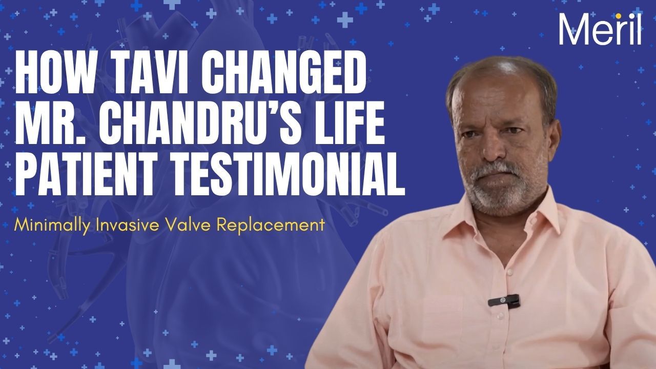 How TAVI Changed Mr. Chandru’s Life | Patient Testimonial