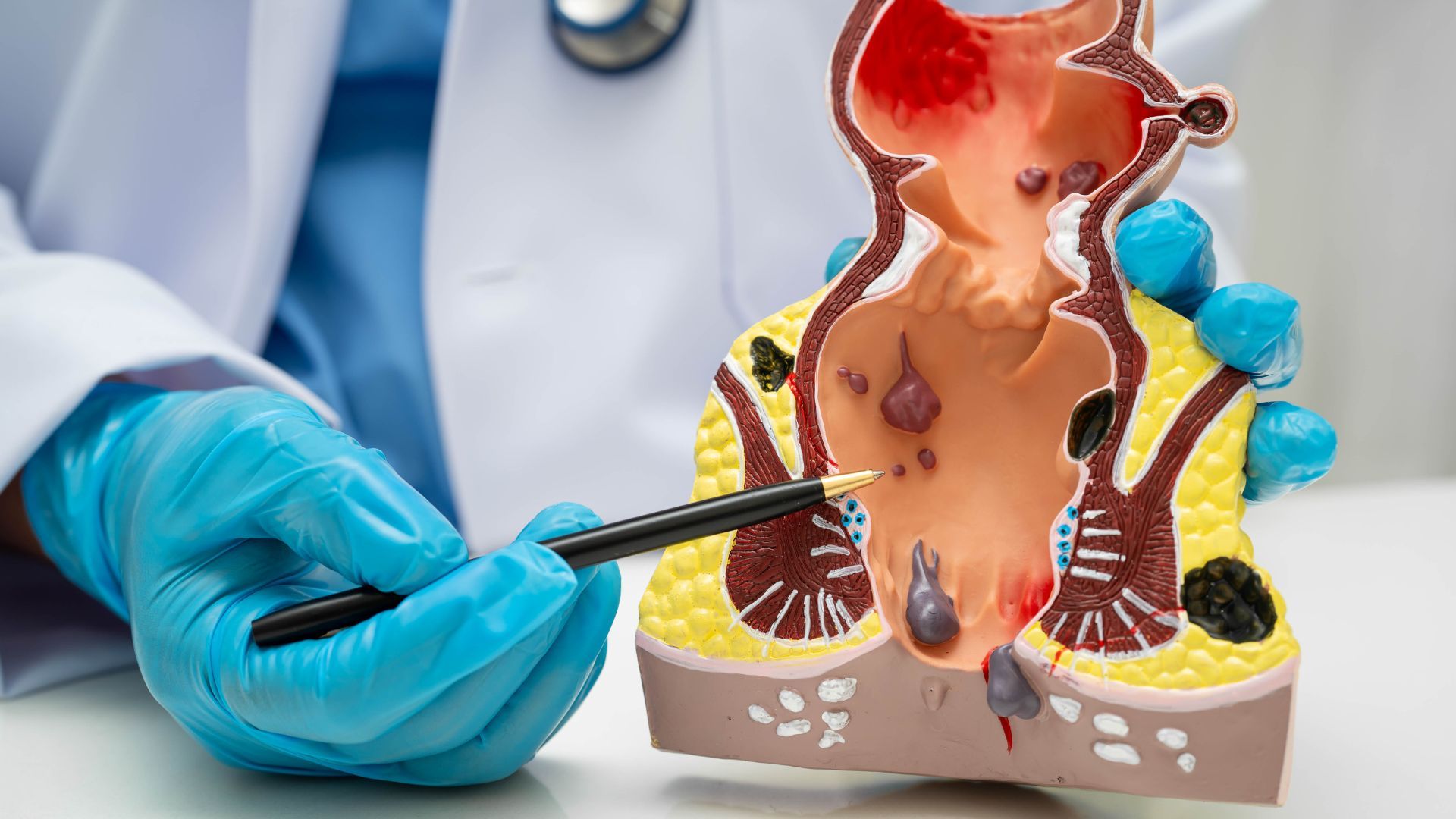 Medical Devices