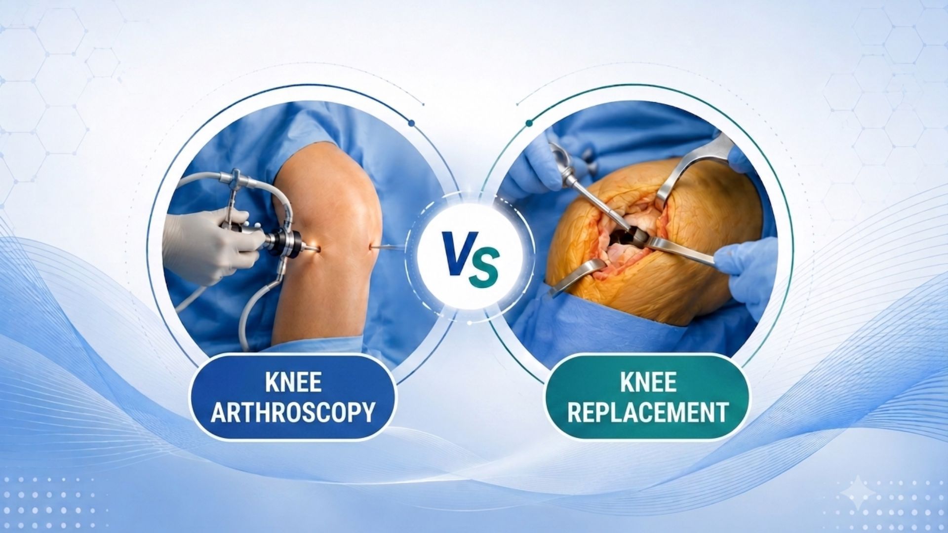 Knee Replacement vs Knee Arthroscopy: What's the Difference?
