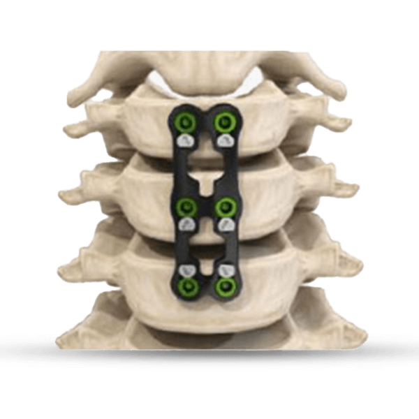 Merilock Anterior Cervical Plate System