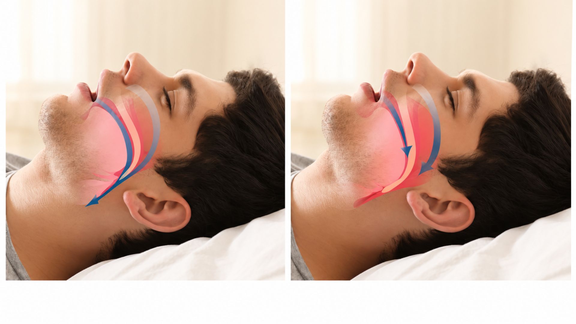 Sleep Apnea: Causes, Symptoms, Risks, and Treatment Options