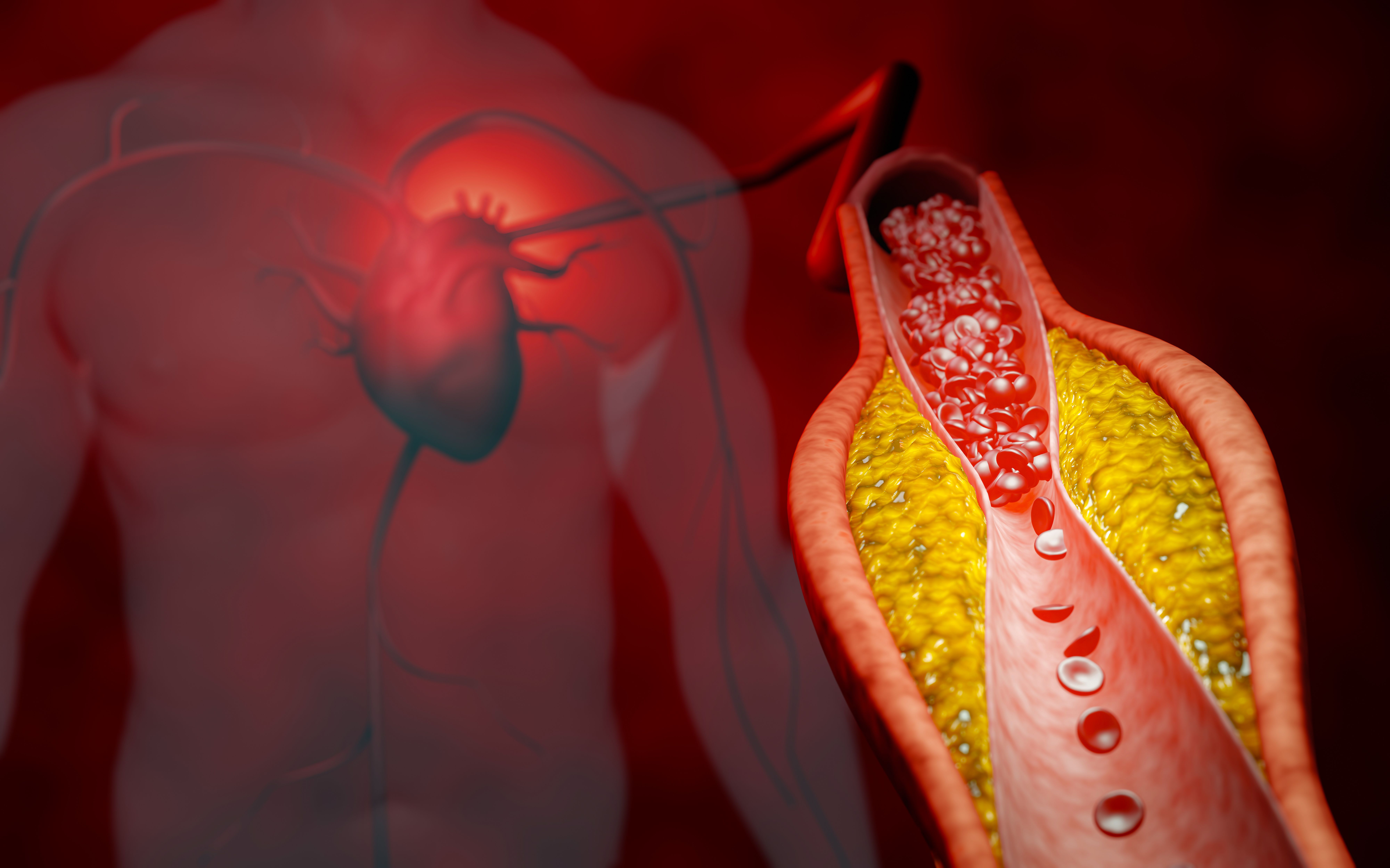 Coronary Artery Disease: Causes, Symptoms & Treatment